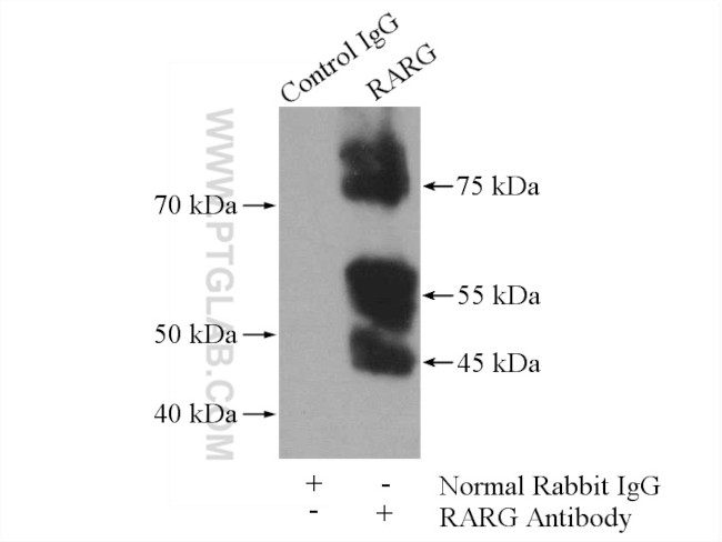 RARG Antibody in Immunoprecipitation (IP)