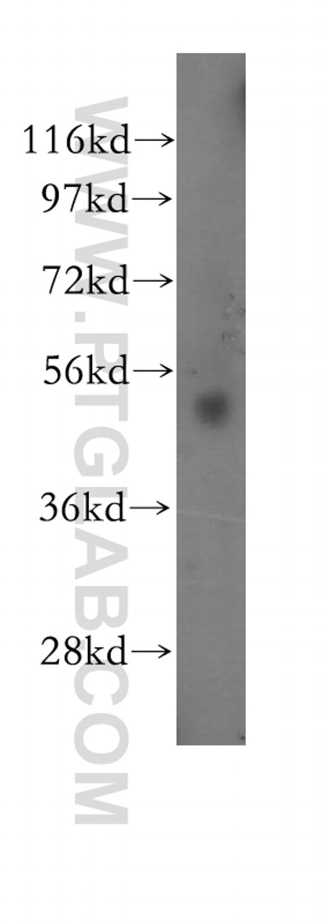 RARG Antibody in Western Blot (WB)