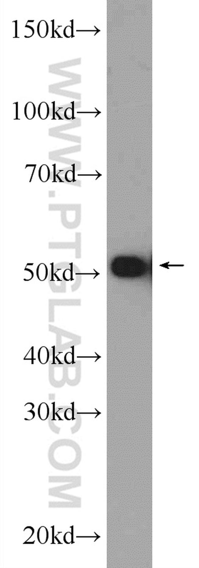 HNRNPK Antibody in Western Blot (WB)