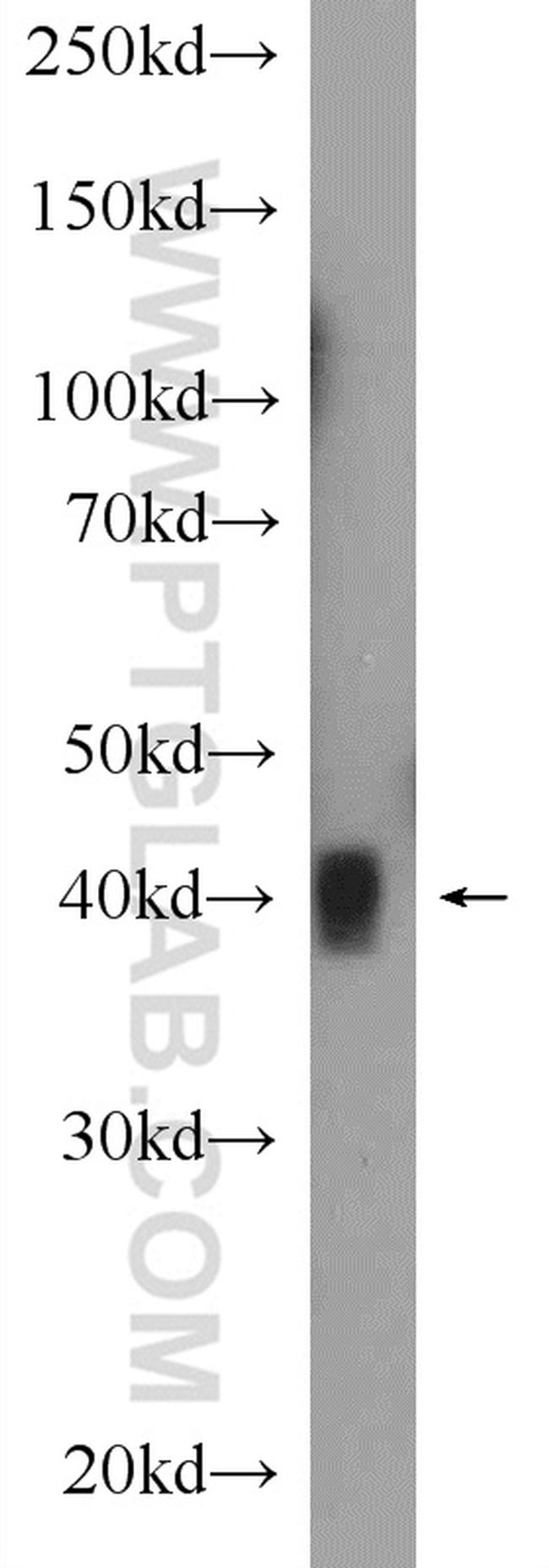 ANKRD1 Antibody in Western Blot (WB)