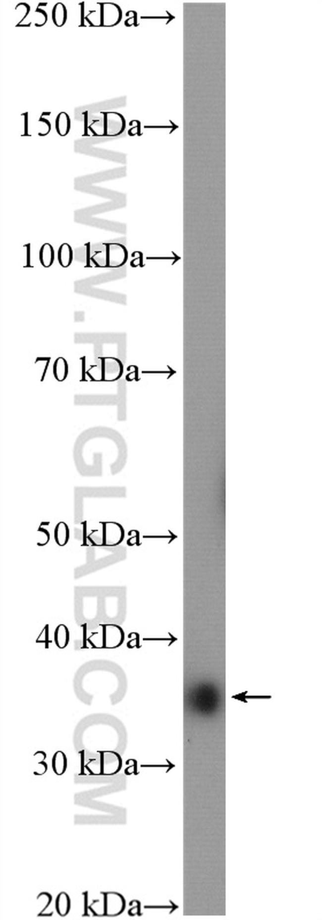 ANKRD1 Antibody in Western Blot (WB)