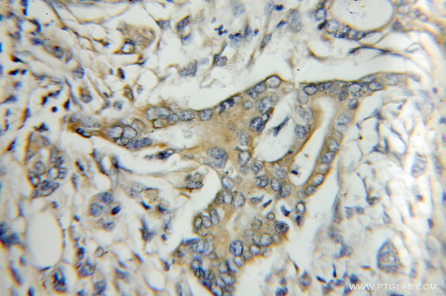 Kallistatin Antibody in Immunohistochemistry (Paraffin) (IHC (P))