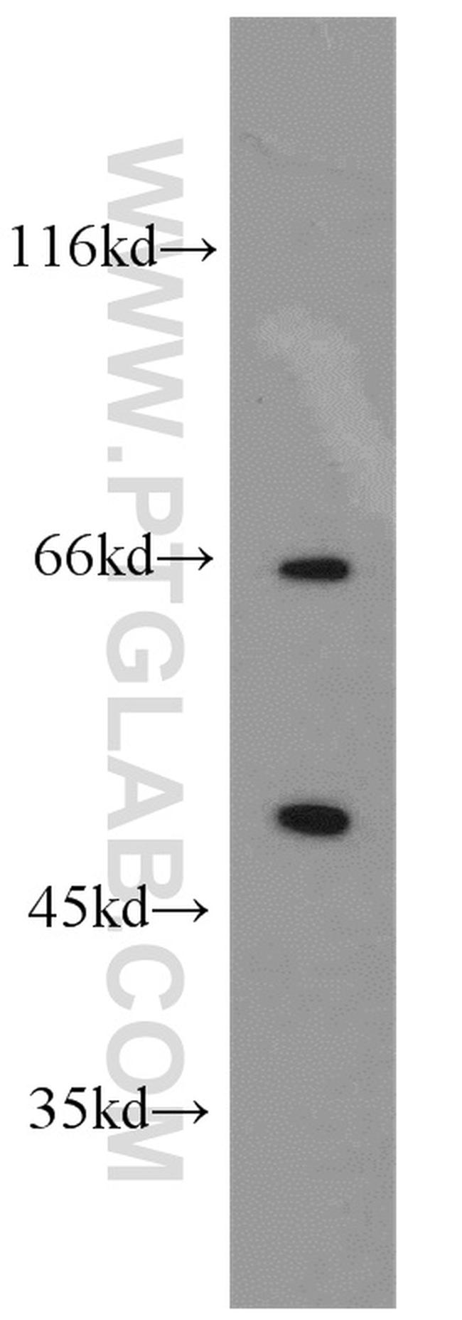 SESN3 Antibody in Western Blot (WB)