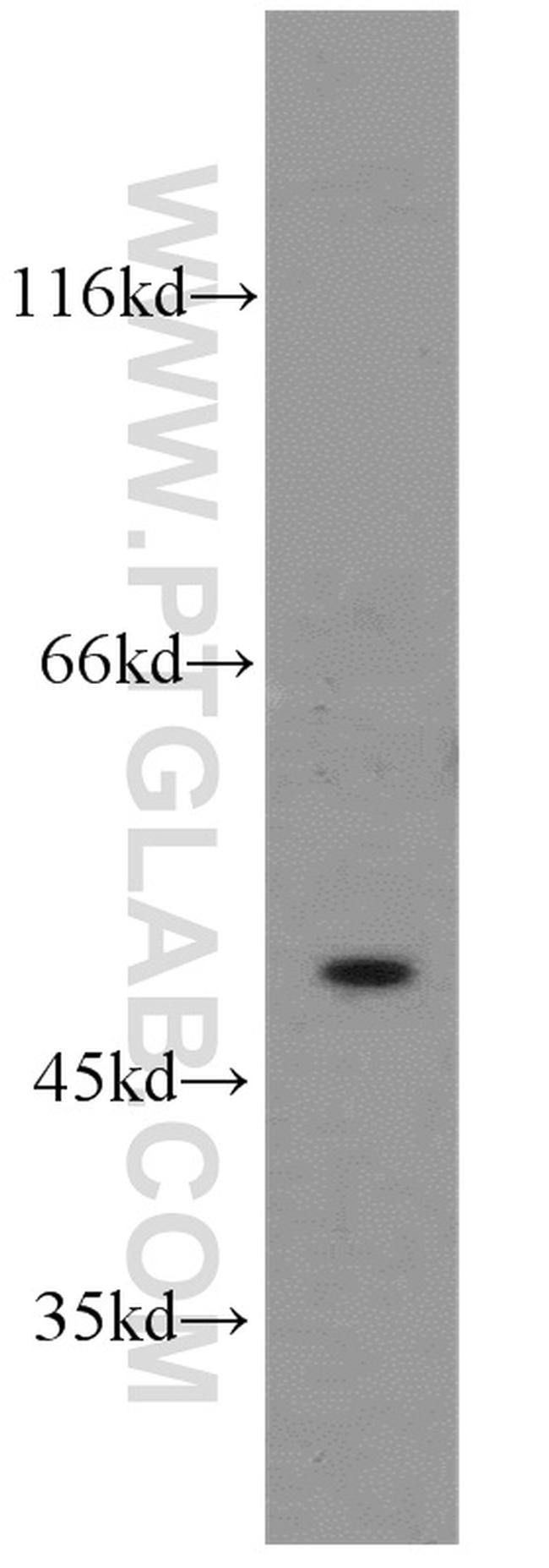 SESN3 Antibody in Western Blot (WB)