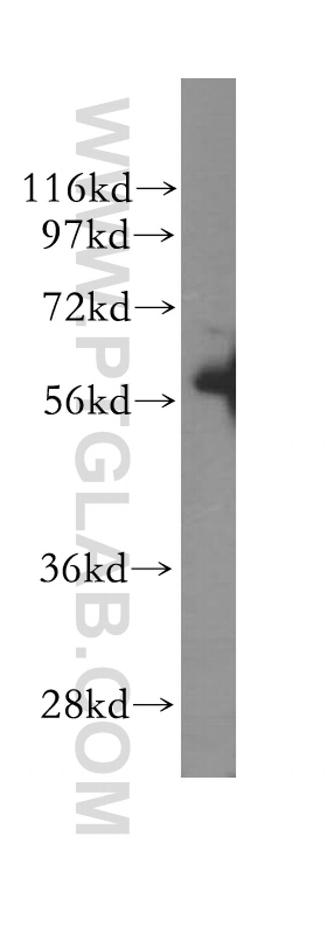 SESN3 Antibody in Western Blot (WB)