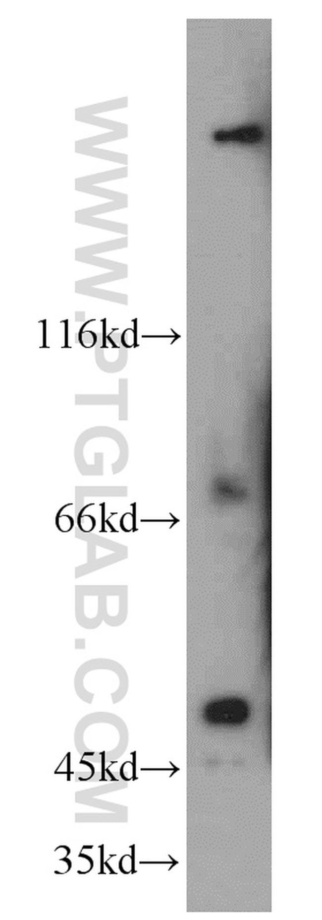 SESN3 Antibody in Western Blot (WB)