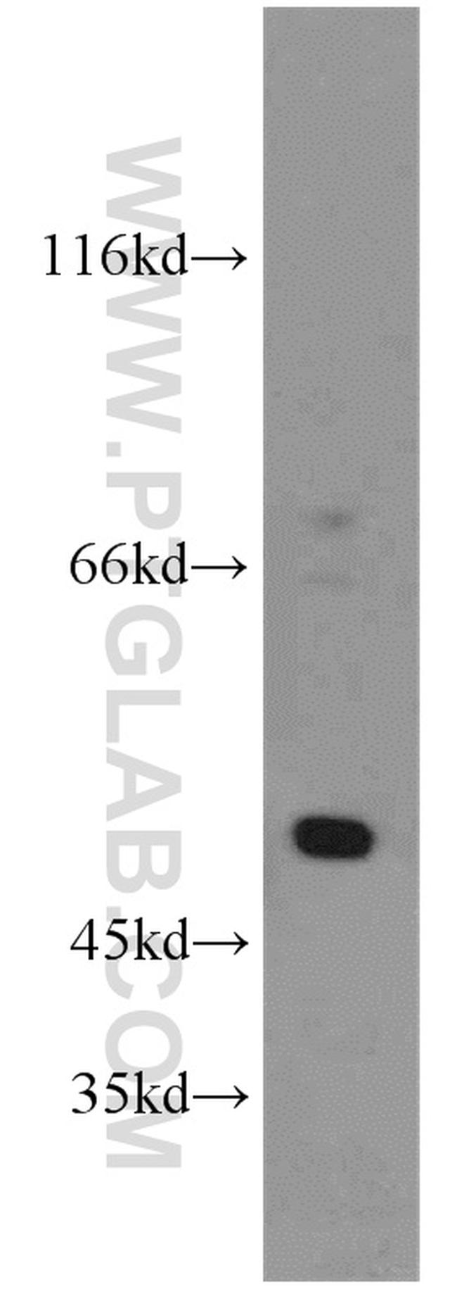 SESN3 Antibody in Western Blot (WB)