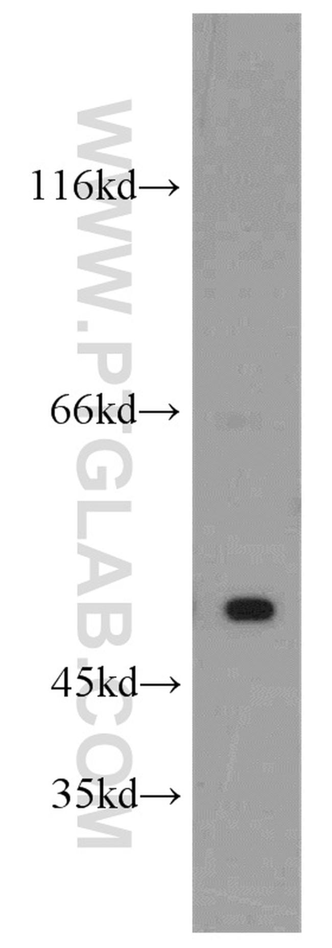 SESN3 Antibody in Western Blot (WB)