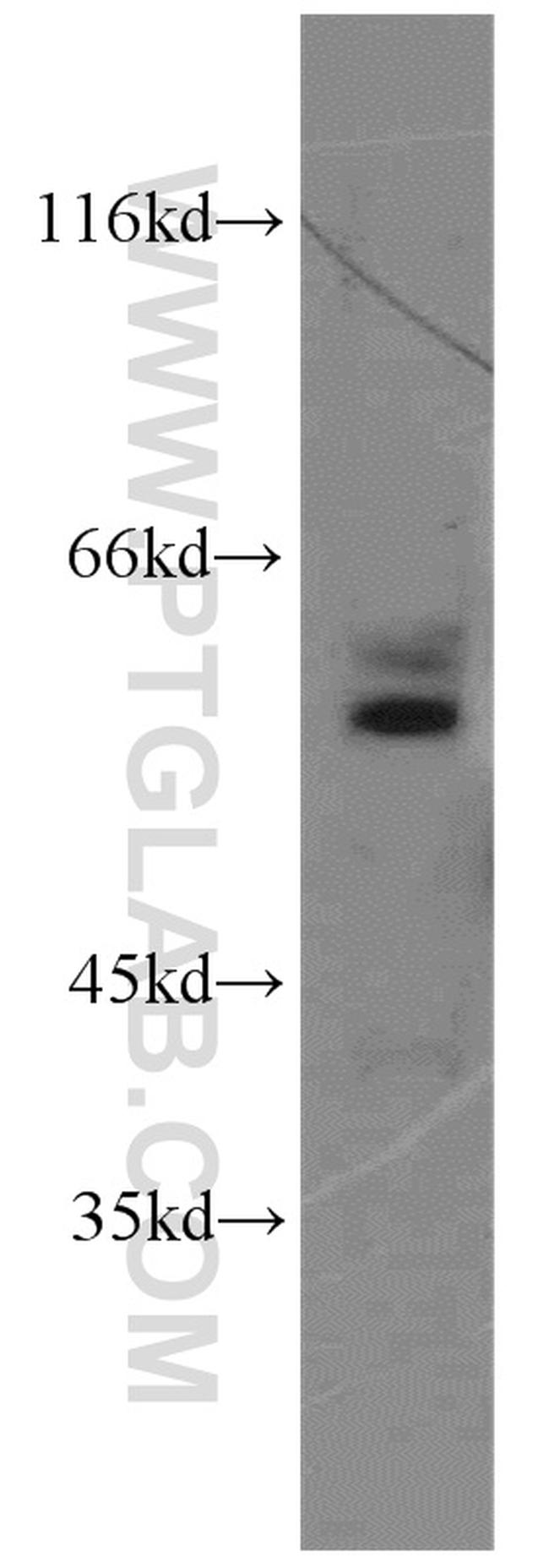 SESN3 Antibody in Western Blot (WB)