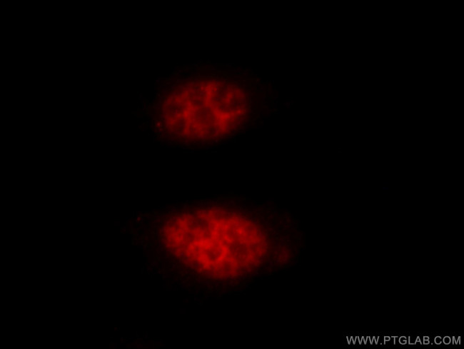 HAT1 Antibody in Immunocytochemistry (ICC/IF)