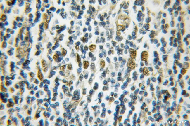 HAT1 Antibody in Immunohistochemistry (Paraffin) (IHC (P))