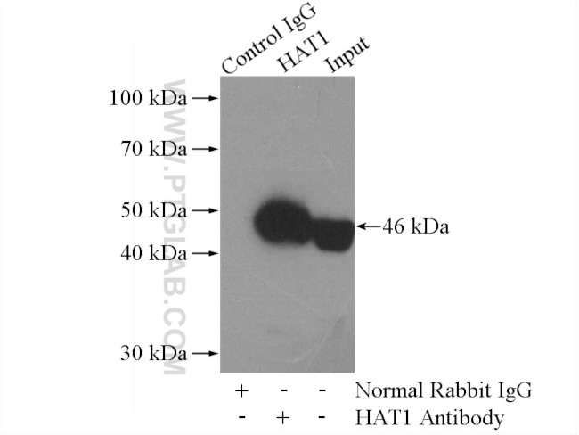 HAT1 Antibody in Immunoprecipitation (IP)