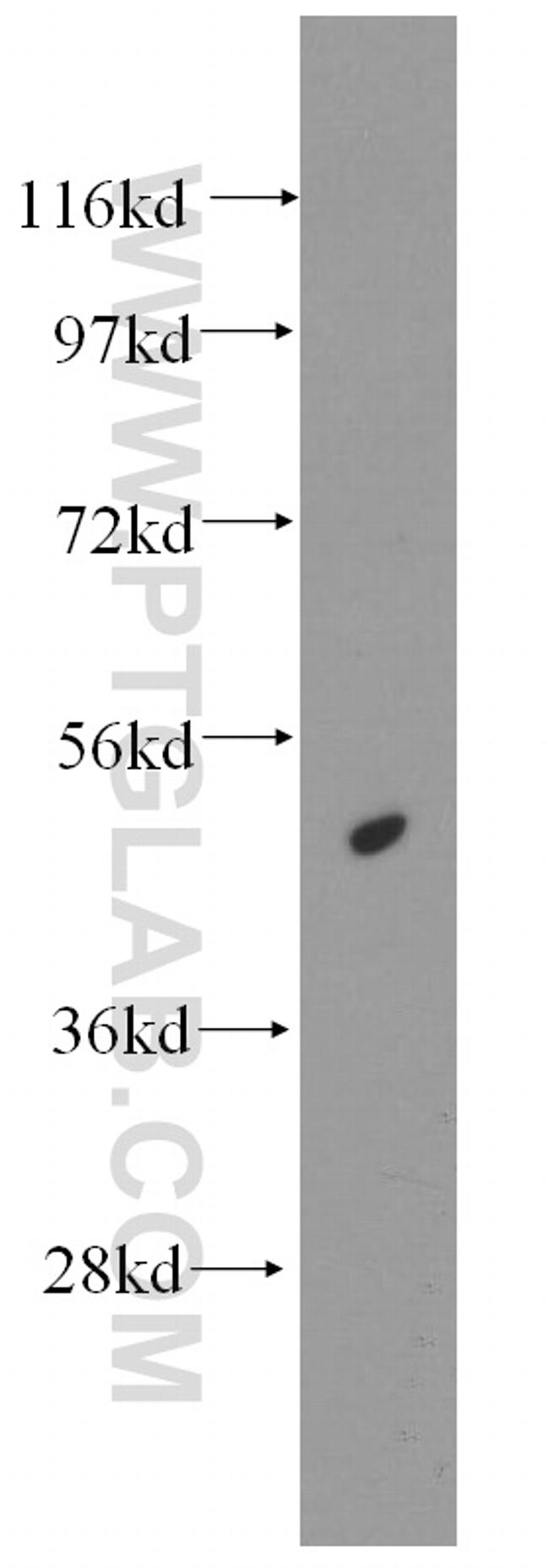 HAT1 Antibody in Western Blot (WB)