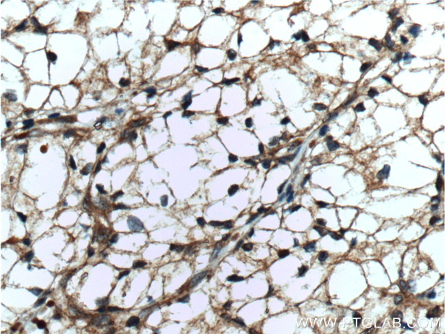 GRK6 Antibody in Immunohistochemistry (Paraffin) (IHC (P))