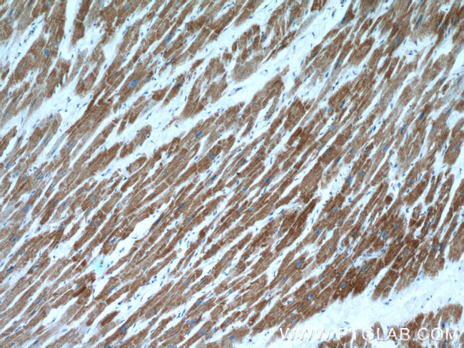 COX15 Antibody in Immunohistochemistry (Paraffin) (IHC (P))