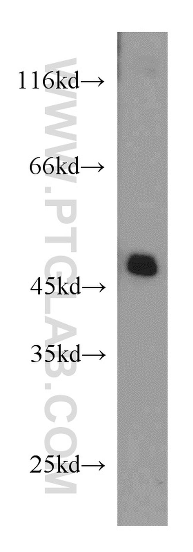 COX15 Antibody in Western Blot (WB)