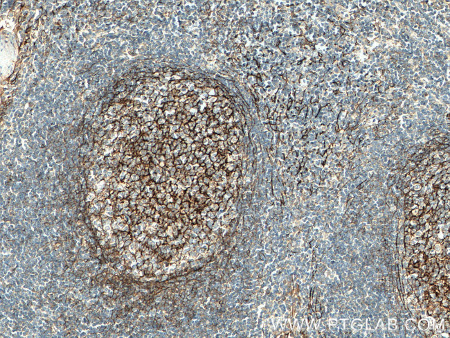 VCAM-1 Antibody in Immunohistochemistry (Paraffin) (IHC (P))