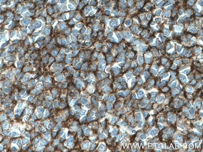 VCAM-1 Antibody in Immunohistochemistry (Paraffin) (IHC (P))