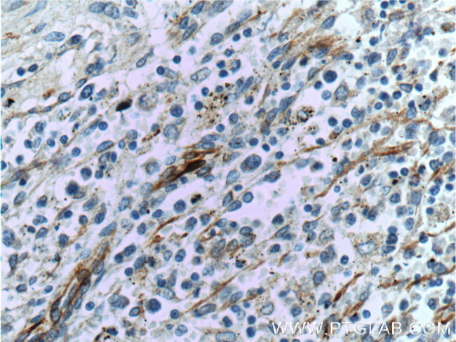 VCAM-1 Antibody in Immunohistochemistry (Paraffin) (IHC (P))