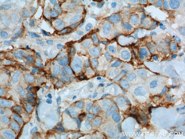 VCAM-1 Antibody in Immunohistochemistry (Paraffin) (IHC (P))