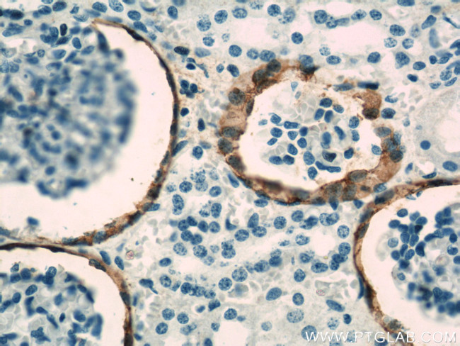 VCAM-1 Antibody in Immunohistochemistry (Paraffin) (IHC (P))