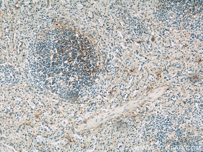 VCAM-1 Antibody in Immunohistochemistry (Paraffin) (IHC (P))