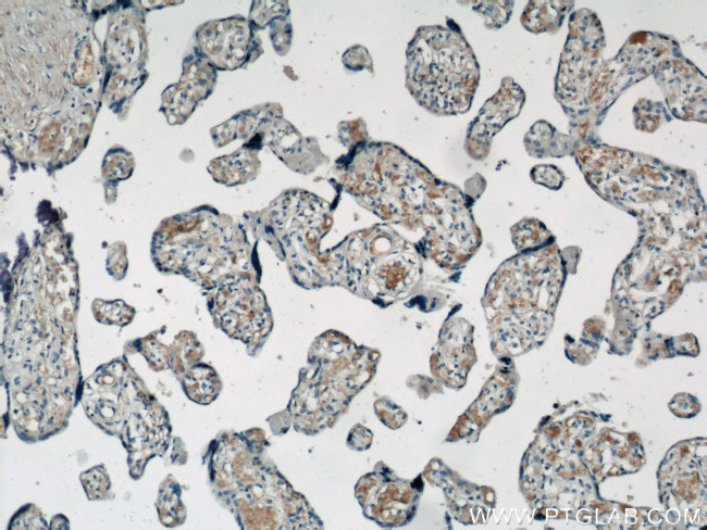 VCAM-1 Antibody in Immunohistochemistry (Paraffin) (IHC (P))