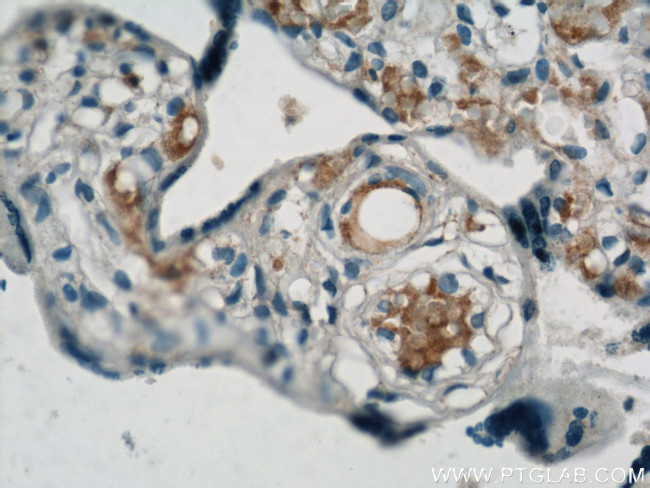 VCAM-1 Antibody in Immunohistochemistry (Paraffin) (IHC (P))