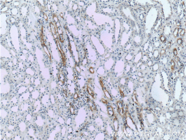 VCAM-1 Antibody in Immunohistochemistry (Paraffin) (IHC (P))