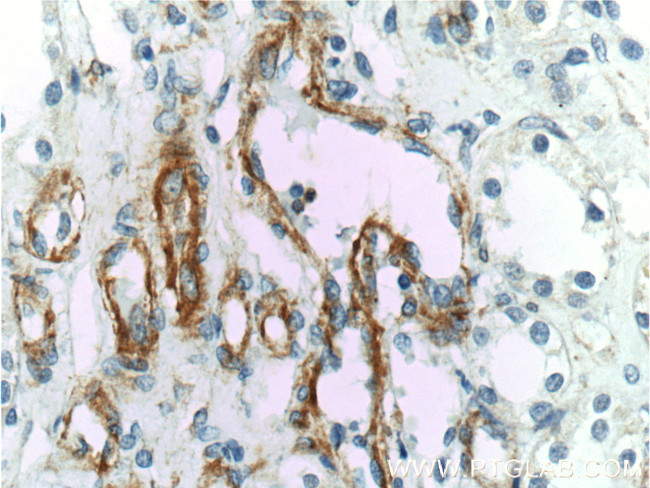 VCAM-1 Antibody in Immunohistochemistry (Paraffin) (IHC (P))