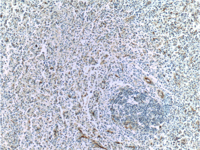 VCAM-1 Antibody in Immunohistochemistry (Paraffin) (IHC (P))