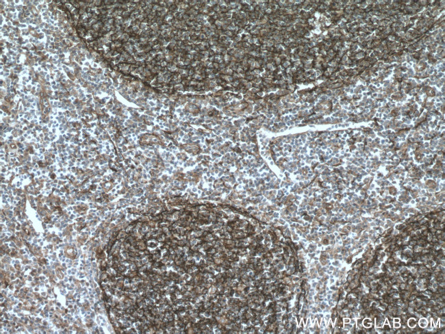 VCAM-1 Antibody in Immunohistochemistry (Paraffin) (IHC (P))