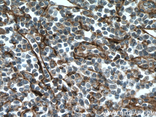 VCAM-1 Antibody in Immunohistochemistry (Paraffin) (IHC (P))