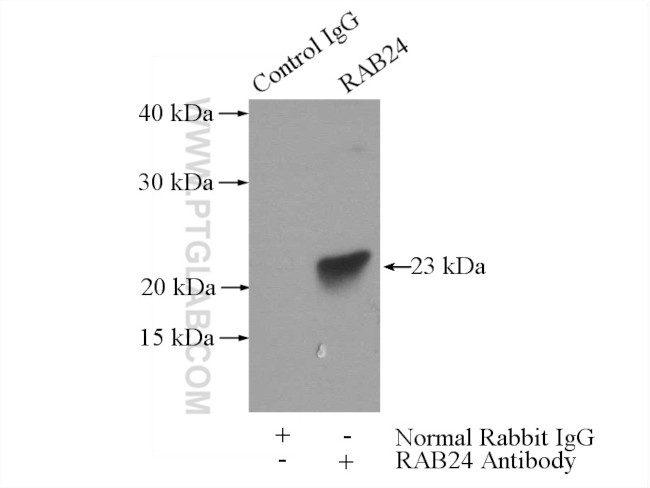 RAB24 Antibody in Immunoprecipitation (IP)