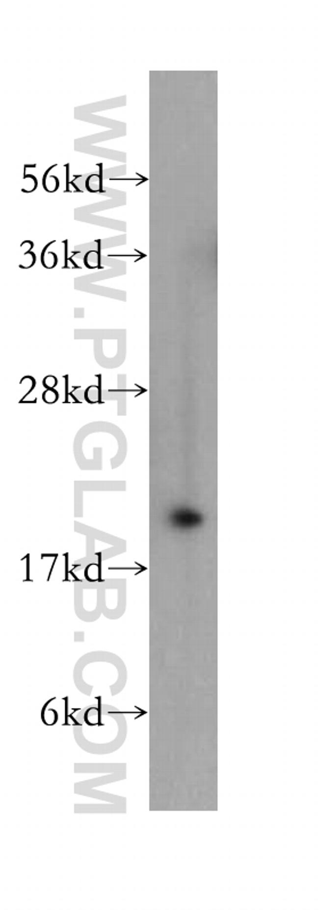 RAB24 Antibody in Western Blot (WB)