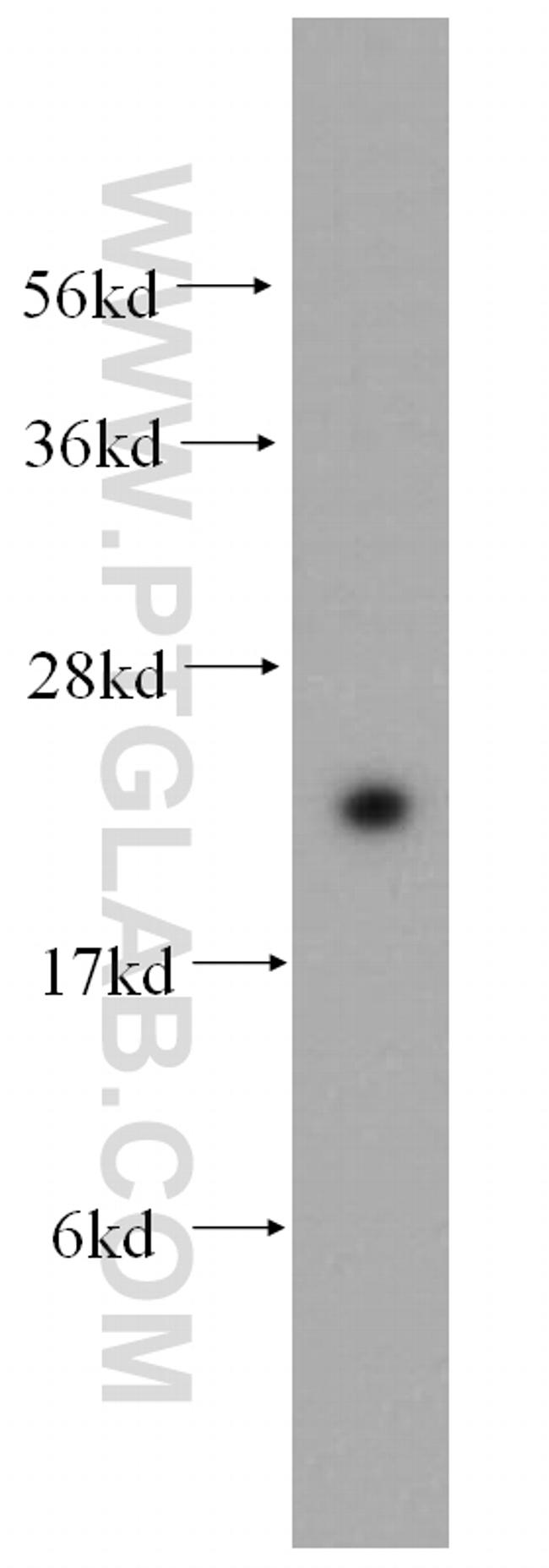 RAB24 Antibody in Western Blot (WB)