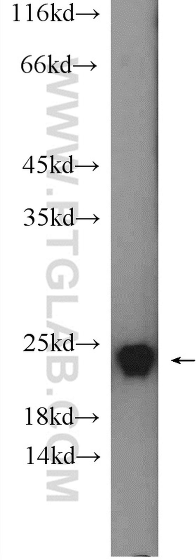 RAB24 Antibody in Western Blot (WB)