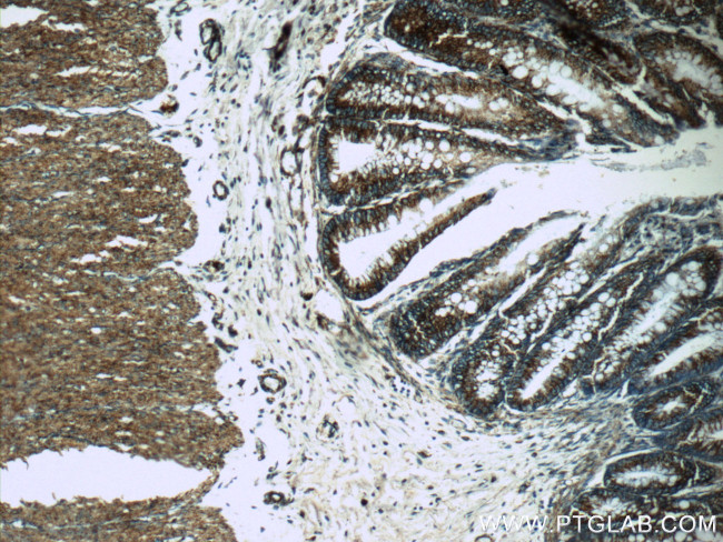 COX5A Antibody in Immunohistochemistry (Paraffin) (IHC (P))