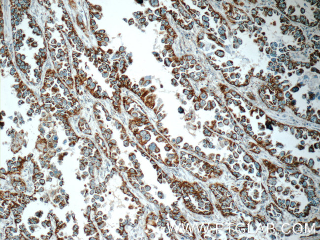 COX5A Antibody in Immunohistochemistry (Paraffin) (IHC (P))