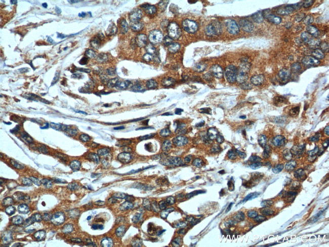 NQO1 Antibody in Immunohistochemistry (Paraffin) (IHC (P))