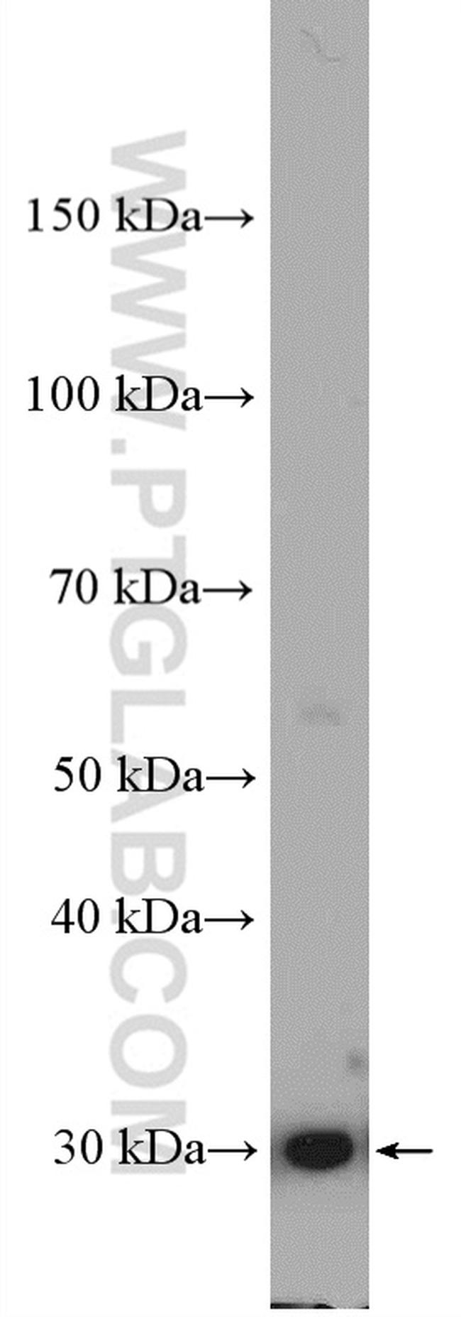 NQO1 Antibody in Western Blot (WB)