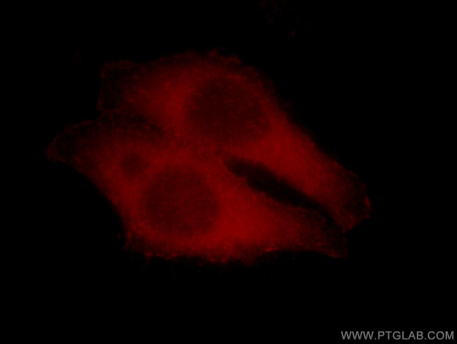 Kindlin 2 Antibody in Immunocytochemistry (ICC/IF)