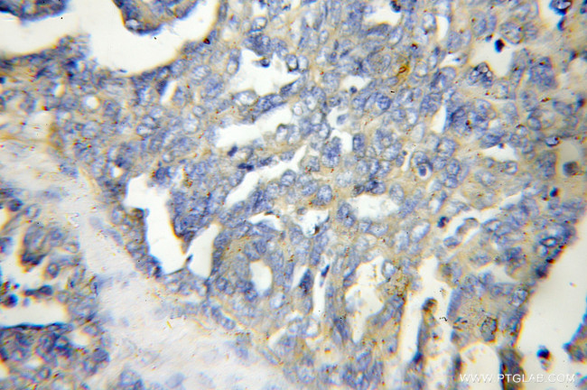 Kindlin 2 Antibody in Immunohistochemistry (Paraffin) (IHC (P))