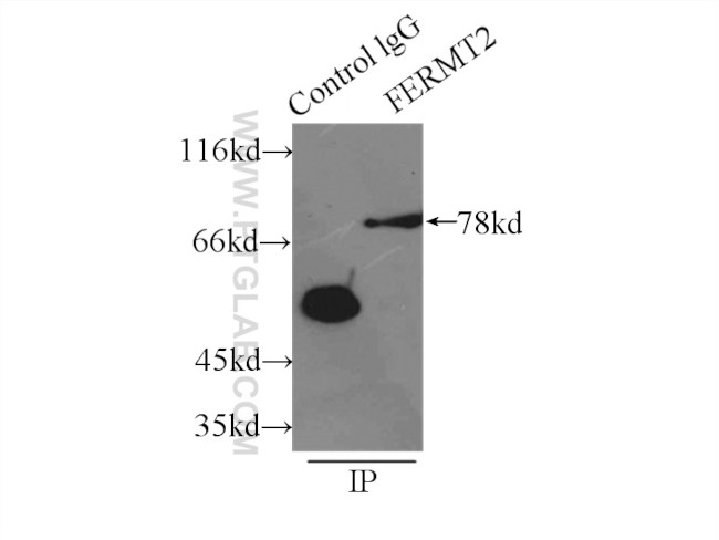 Kindlin 2 Antibody in Immunoprecipitation (IP)