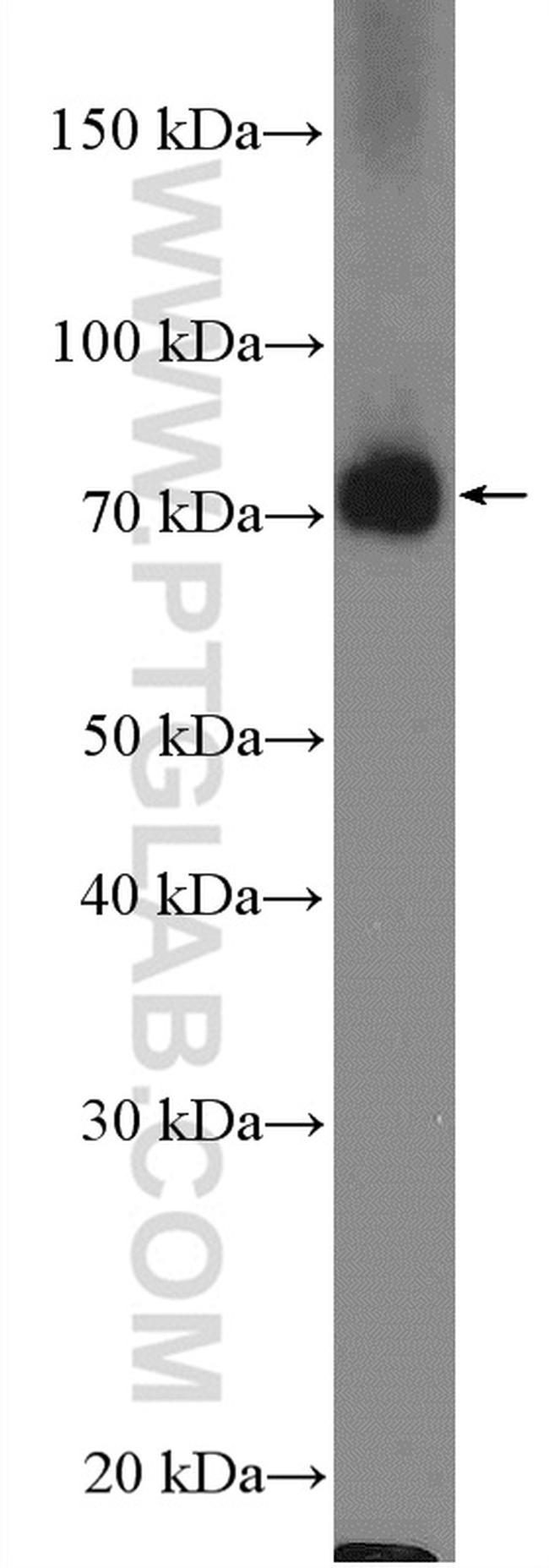 Kindlin 2 Antibody in Western Blot (WB)