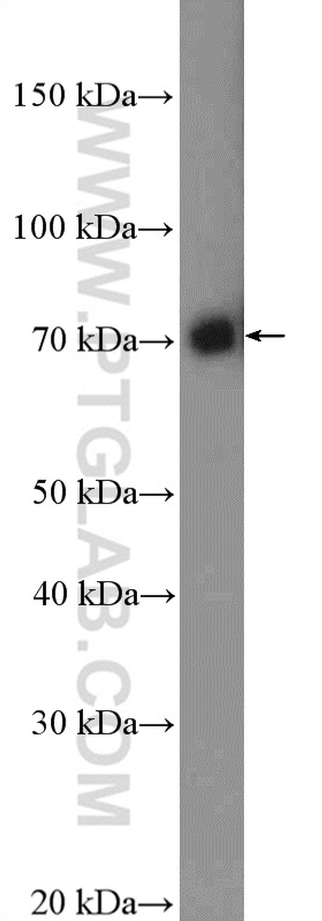 Kindlin 2 Antibody in Western Blot (WB)