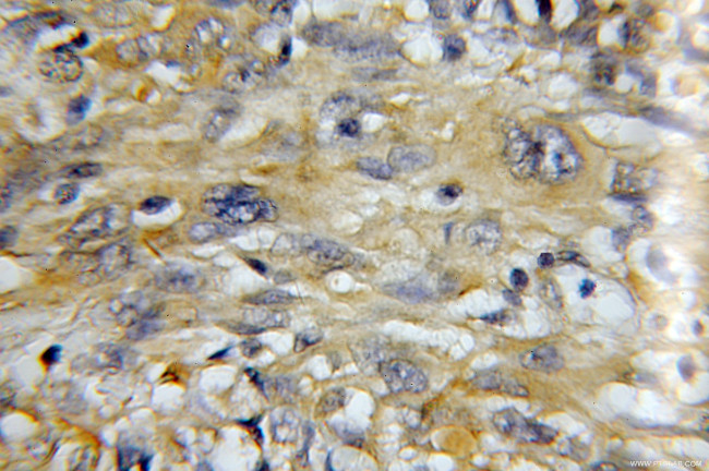 MZB1 Antibody in Immunohistochemistry (Paraffin) (IHC (P))