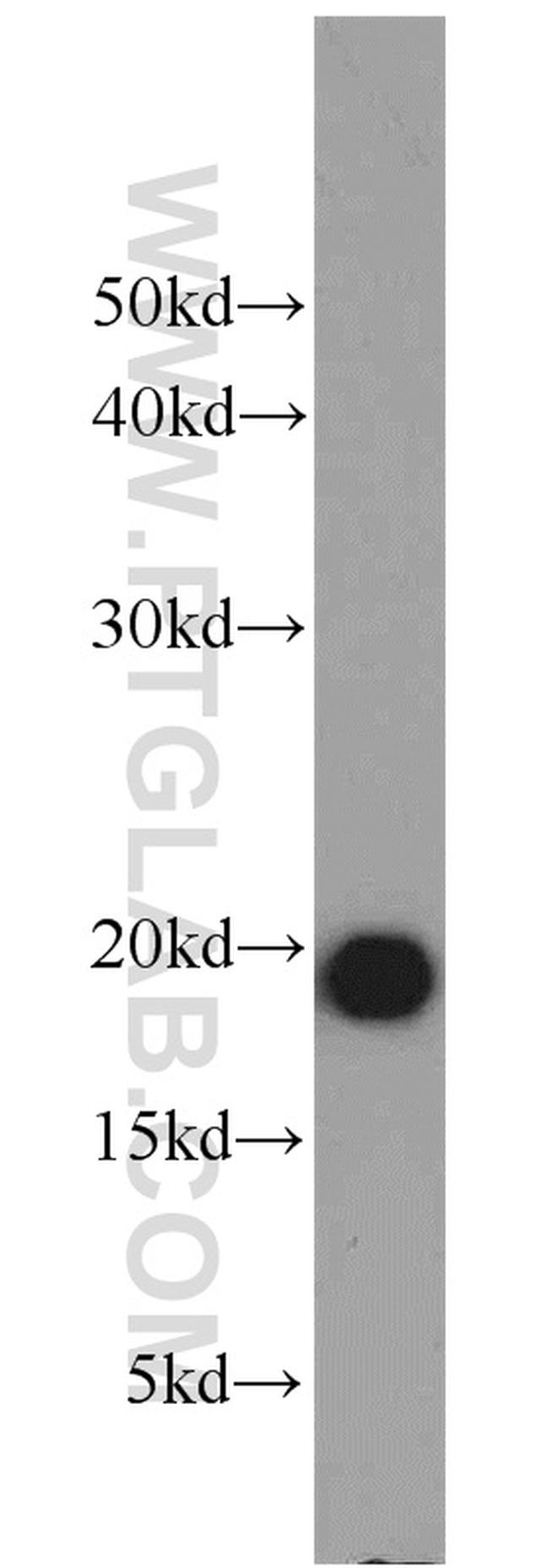 MZB1 Antibody in Western Blot (WB)