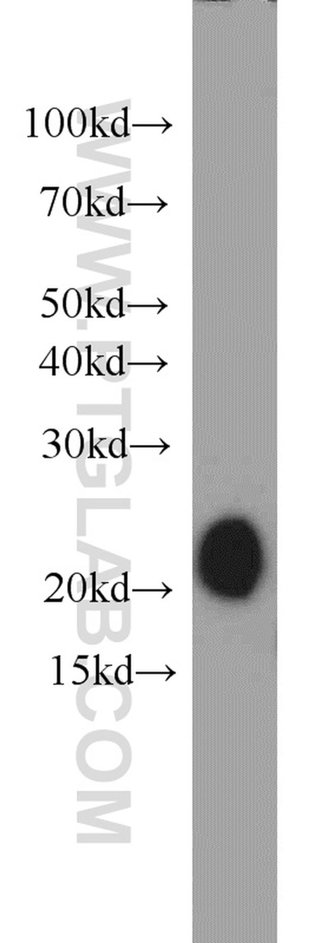 MZB1 Antibody in Western Blot (WB)