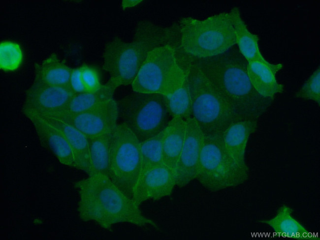 S100A16 Antibody in Immunocytochemistry (ICC/IF)